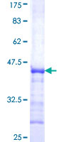 ab153023 on a 12.5% SDS-PAGE stained with Coomassie Blue.