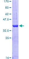 ab153024 on a 12.5% SDS-PAGE stained with Coomassie Blue.