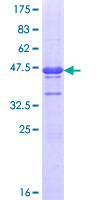 ab163261 on a 12.5% SDS-PAGE stained with Coomassie Blue.