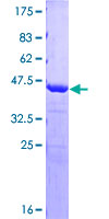 ab161441 on a 12.5% SDS-PAGE stained with Coomassie Blue.