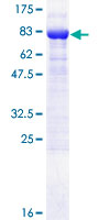 ab161726 on a 12.5% SDS-PAGE stained with Coomassie Blue.