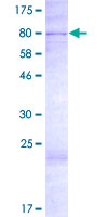 ab165222 on a 12.5% SDS-PAGE stained with Coomassie Blue.