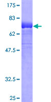 ab164026 on a 12.5% SDS-PAGE stained with Coomassie Blue.