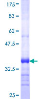 ab164027 on a 12.5% SDS-PAGE stained with Coomassie Blue.