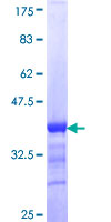 ab165829 on a 12.5% SDS-PAGE stained with Coomassie Blue.