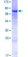 ab165549 on a 12.5% SDS-PAGE stained with Coomassie Blue.