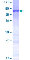 ab158807 on a 12.5% SDS-PAGE stained with Coomassie Blue.