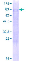 ab166256 on a 12.5% SDS-PAGE stained with Coomassie Blue.