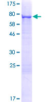 ab164982 on a 12.5% SDS-PAGE stained with Coomassie Blue.
