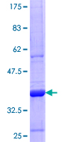 ab164983 on a 12.5% SDS-PAGE stained with Coomassie Blue.