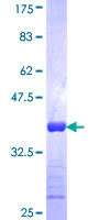 ab160347 on a 12.5% SDS-PAGE stained with Coomassie Blue.