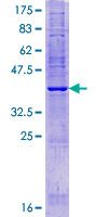 ab165857 on a 12.5% SDS-PAGE stained with Coomassie Blue.