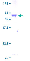 ab158806 on a 12.5% SDS-PAGE stained with Coomassie Blue.