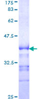 ab152923 on a 12.5% SDS-PAGE stained with Coomassie Blue.
