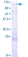 ab166135 on a 12.5% SDS-PAGE stained with Coomassie Blue.