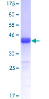 ab166136 on a 12.5% SDS-PAGE stained with Coomassie Blue.