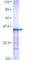 ab160276 on a 12.5% SDS-PAGE stained with Coomassie Blue.