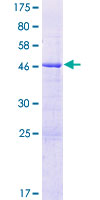 ab165138 on a 12.5% SDS-PAGE stained with Coomassie Blue.