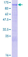 ab164595 on a 12.5% SDS-PAGE stained with Coomassie Blue.