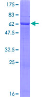 ab158814 on a 12.5% SDS-PAGE stained with Coomassie Blue.