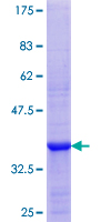 ab158815 on a 12.5% SDS-PAGE stained with Coomassie Blue.