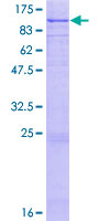 ab158834 on a 12.5% SDS-PAGE stained with Coomassie Blue.