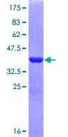 ab158811 on a 12.5% SDS-PAGE stained with Coomassie Blue.