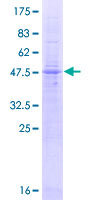 ab160633 on a 12.5% SDS-PAGE stained with Coomassie Blue.