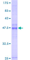 ab163080 on a 12.5% SDS-PAGE stained with Coomassie Blue.