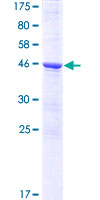 ab162972 on a 12.5% SDS-PAGE stained with Coomassie Blue.