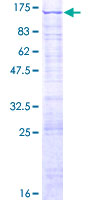 ab164379 on a 12.5% SDS-PAGE stained with Coomassie Blue.