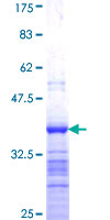 ab165906 on a 12.5% SDS-PAGE stained with Coomassie Blue.