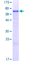 ab165506 on a 12.5% SDS-PAGE stained with Coomassie Blue.