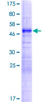 ab164764 on a 12.5% SDS-PAGE stained with Coomassie Blue.