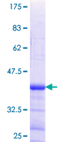 ab164765 on a 12.5% SDS-PAGE stained with Coomassie Blue.