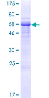 ab166223 on a 12.5% SDS-PAGE stained with Coomassie Blue.