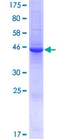 ab166478 on a 12.5% SDS-PAGE stained with Coomassie Blue.