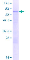 ab164597 on a 12.5% SDS-PAGE stained with Coomassie Blue.