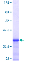 ab164598 on a 12.5% SDS-PAGE stained with Coomassie Blue.