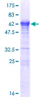 ab166031 on a 12.5% SDS-PAGE stained with Coomassie Blue.