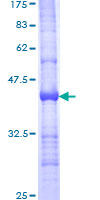 ab152925 on a 12.5% SDS-PAGE stained with Coomassie Blue.