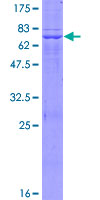 ab164908 on a 12.5% SDS-PAGE stained with Coomassie Blue.