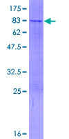 ab165842 on a 12.5% SDS-PAGE stained with Coomassie Blue.