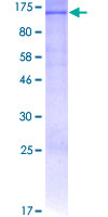 12.5% SDS-PAGE analysis of ab152498 stained with Coomassie Blue.