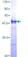 ab153336 on a 12.5% SDS-PAGE stained with Coomassie Blue.
