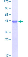 ab153337 on a 12.5% SDS-PAGE stained with Coomassie Blue.