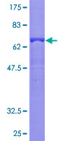 ab159691 on a 12.5% SDS-PAGE stained with Coomassie Blue.