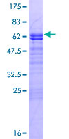 ab163360 on a 12.5% SDS-PAGE stained with Coomassie Blue.