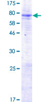 ab163988 on a 12.5% SDS-PAGE stained with Coomassie Blue.