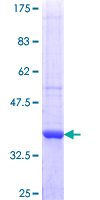ab163989 on a 12.5% SDS-PAGE stained with Coomassie Blue.